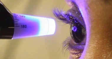 هكذا يؤثر مرض السكر على عينيك.. 5 نصائح لحماية بصرك