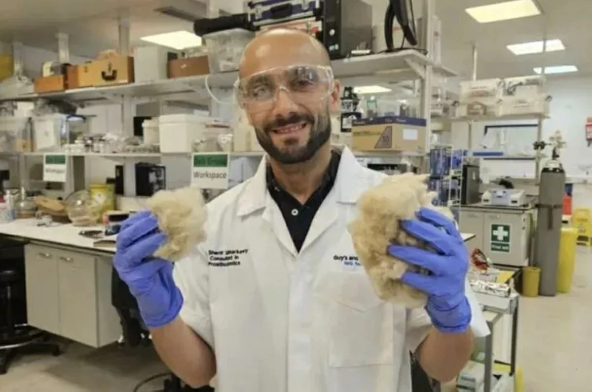 ستاد الاهلي :  صوف الأغنام مادة لإصلاح العظام