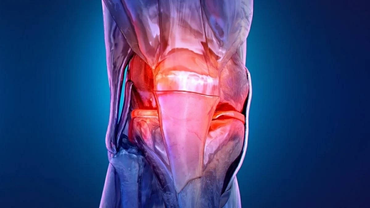 العلاج الكهربائي كوسيلة فعالة لتقليل أعراض التهاب المفاصل التنكسي