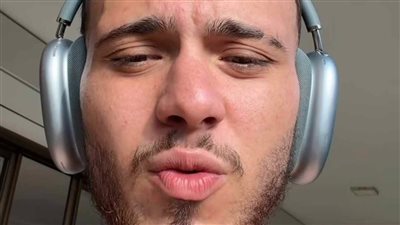 بعد قيامهم برسم تاتو باسمه.. الشامي يحذر جمهوره: بلاش تعملوا كدا