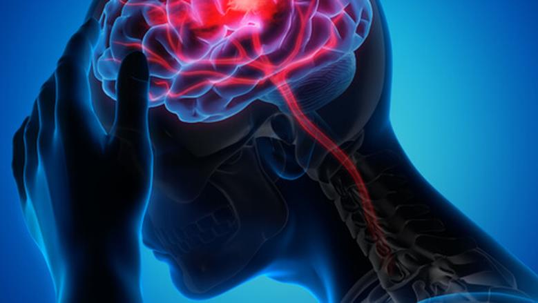 تظهر في الوجه والأطراف.. 5 علامات مبكرة تحذرك من خطر السكتة الدماغية