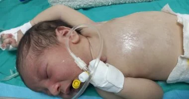 قلب صغير يصارع من أجل الحياة فى غزة”.. الرضيع يحيى أبو طعيمة 21 يوما فقط يواجه تشوهات قلبية معقدة ويحتاج لجراحة عاجلة خارج القطاع.. ووالدته تناشد:”فقدت ابنا من قبل وربنا عوضني بيحيى.. أنقذوه قبل فوات الأوان