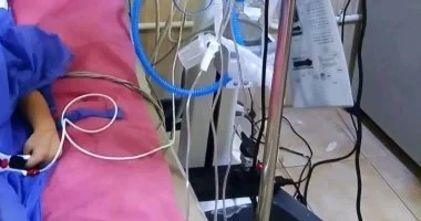 إنقاذ طفل في الثالثة من عمره من نزيف فى المخ بكفر الشيخ