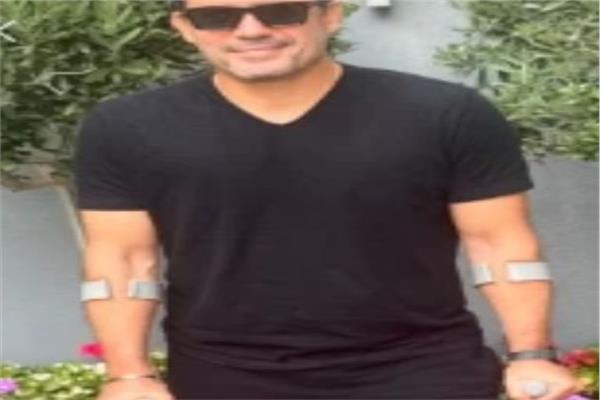 ظافر العابدين يكشف عن إصابته بكسر في القدم ويطمئن جمهوره