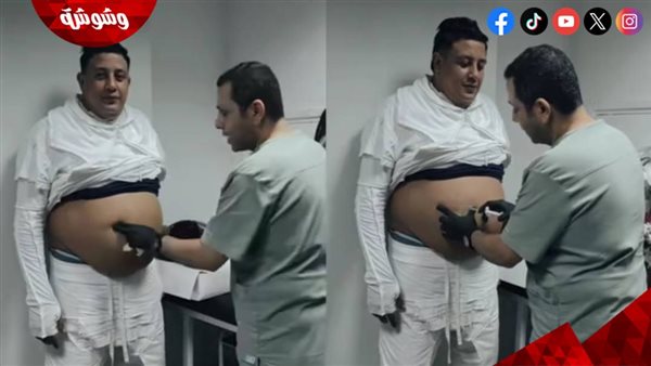 حمو بيكا يستعرض خسارته للوزن برسالة قوية: «اللي كان بيتريق امبارح هيقول النهارده ما شاء الله»