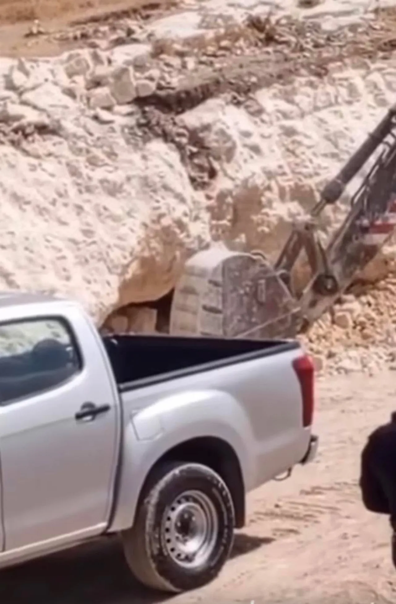 انتفاخ البطن ليس واحدا عند الجميع.. كيف تعرف السبب؟