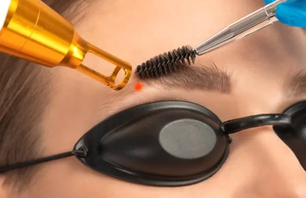 إزالة تاتو الحواجب.. خطوات مهمة قبل وبعد الجلسة…