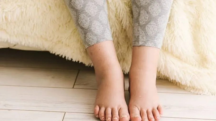 4 أسباب لتورم الجسم لا علاقة لها بالكلى…