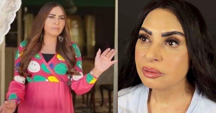 سلوى خطاب تكشف سبب خضوعها لعملية تجميل: الدهون كانت مضايقاني وشيلتها – الأسبوع