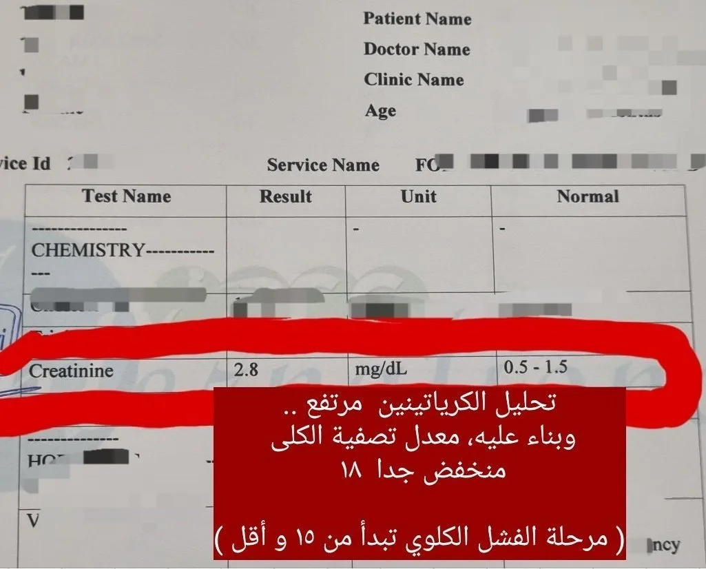 استشاري: حكة شديدة تكشف قصورًا كلويًا متقدمًا لدى مريضة سكري